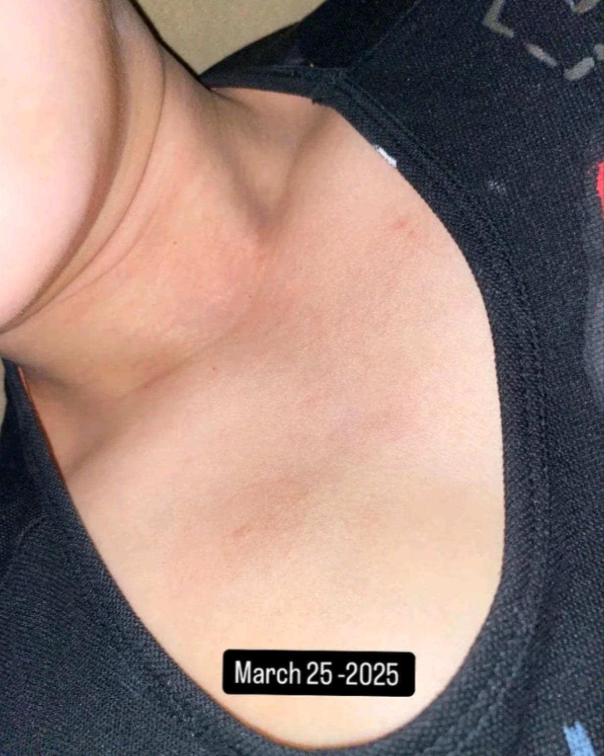 rayover_2026-01-02T10:01:39.914Z