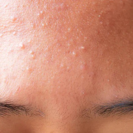 rayover_2026-04-04T18:07:48.067Z